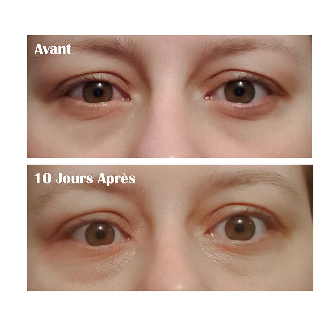 👁️ Sérum Anti-Cernes & Anti-Poches – 100 % Bio – Fabriqué en France - Univers Bio Pharma